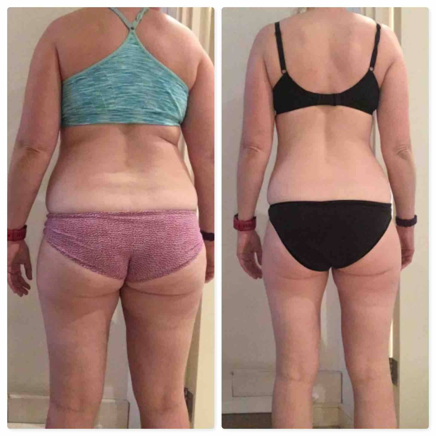 Caroline Mabey (before _ after)